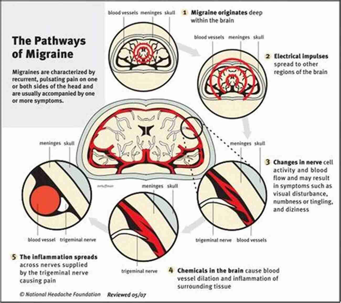 Chronic Headaches Unlocking The Science Chronic Headaches: Biology Psychology And Behavioral Treatment